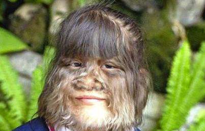 4. Hairiest Teenager 10 More Bizarre World Records