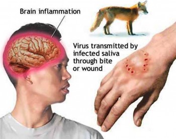 6. Rabies e1318356179423 Top 10 Viral Diseases in the World