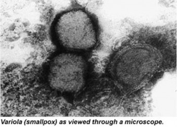 7. Smallpox e1318356088409 Top 10 Viral Diseases in the World
