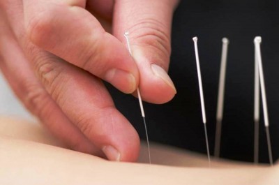 Top 10 Healthy Gifts for Father’s Day 7. Acupuncture e1338530700788 Top 10 Healthy Gifts for Father’s Day