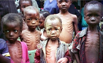 1. Nigeria e1350405582321 Top 10 Most Malnourished Nations in the World