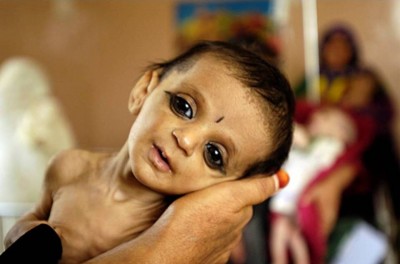 4. Afghanistan e1350405612747 Top 10 Most Malnourished Nations in the World