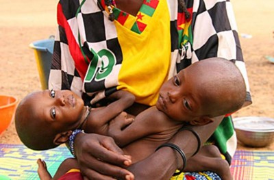 7. Burkina Faso e1350405640532 Top 10 Most Malnourished Nations in the World