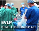 7. Ex Vivo Lung Perfusion