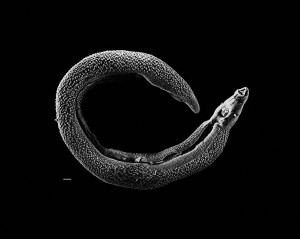 1024px-Schistosoma_20041-300
