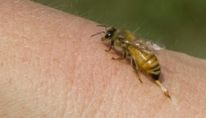 Home-Remedies-for-Bee-Sting-780x450